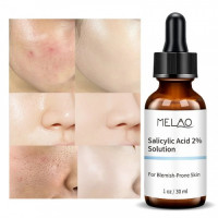 Melao Salicylic Acid 2% Solution 30ml